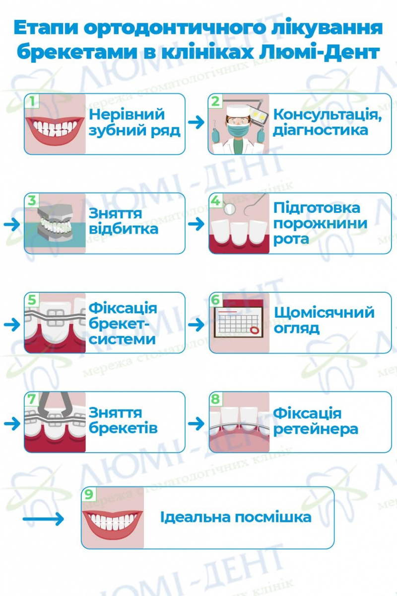 Скупченість зубів ортодонтія фото ЛюміДент