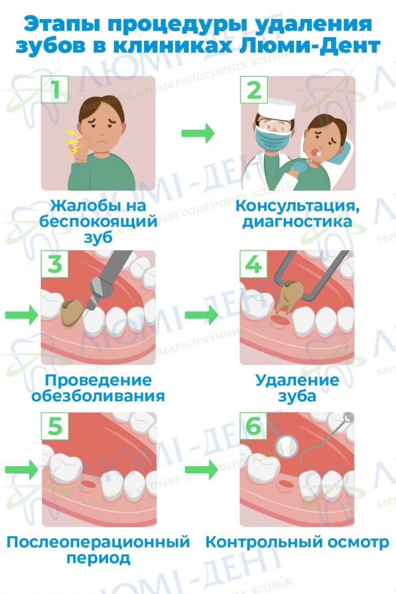Удаление зубов фото Люми-Дент