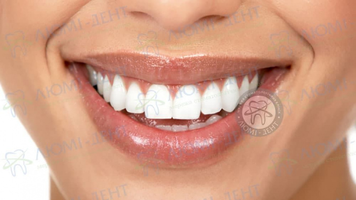 Білі зуби фото ЛюміДент