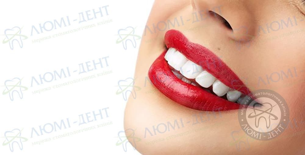Отбеливание зубов: сияющая улыбка за один визит к стоматологу
