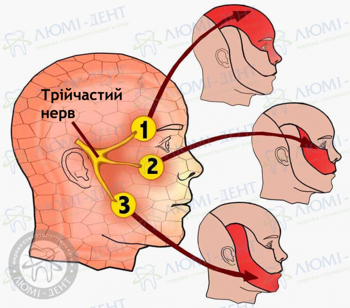 Трійчастий нерв фото ЛюміДент