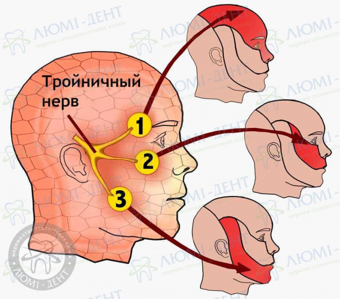 Тройничный нерв фото ЛюмиДент