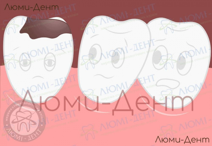 Народные средства от зубной боли фото ЛюмиДент