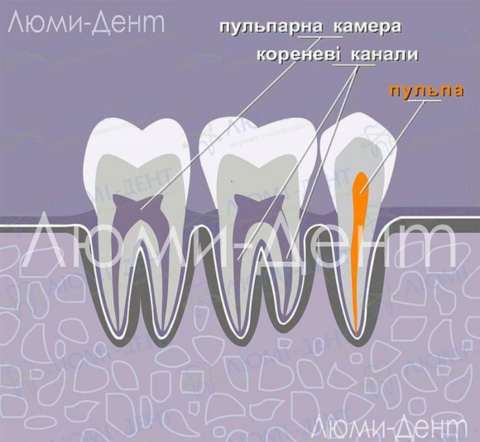 Структура зубів Що робити коли болить зуб народні методи фото Люмі-Дент