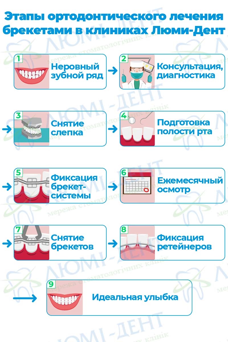 Этапы выравнивания зубов брекетами фото Люми-Дент