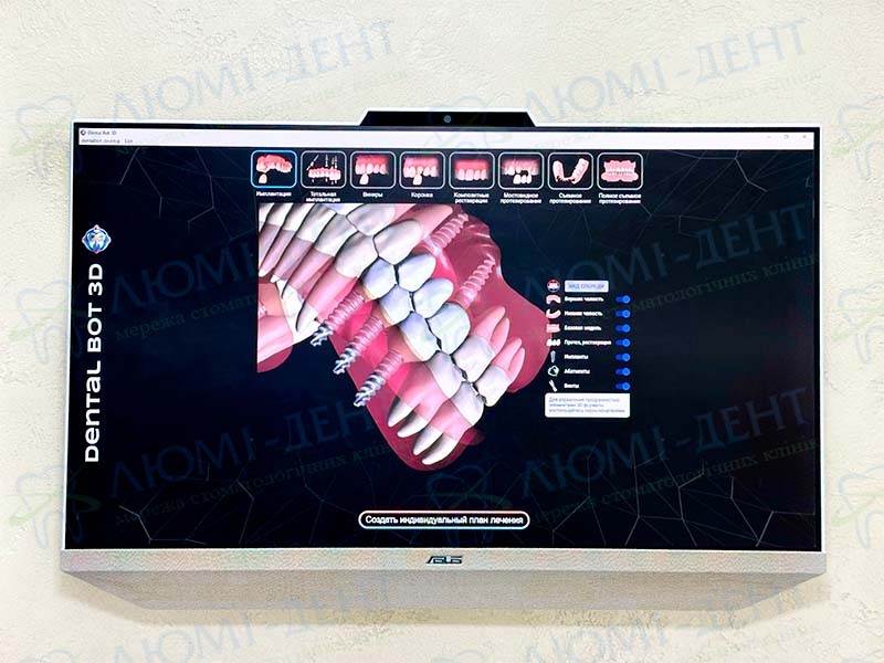 Виртуальный консультант Dental Bot 3D Консультация стоматолога