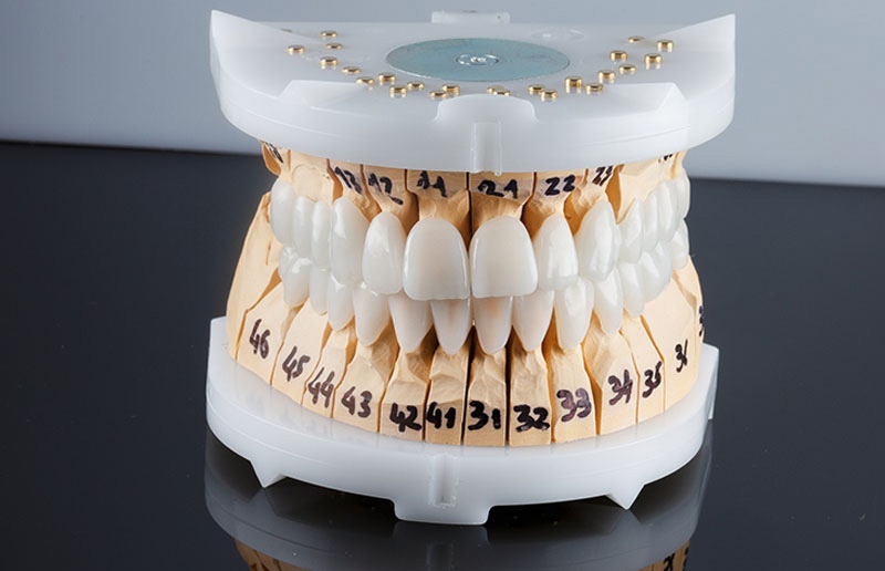 Современная зуботехническая лаборатория Киев фото Люми-Дент