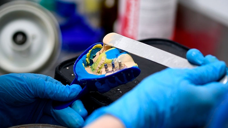 Стоматологические зубные техники Киев фото Люми-Дент