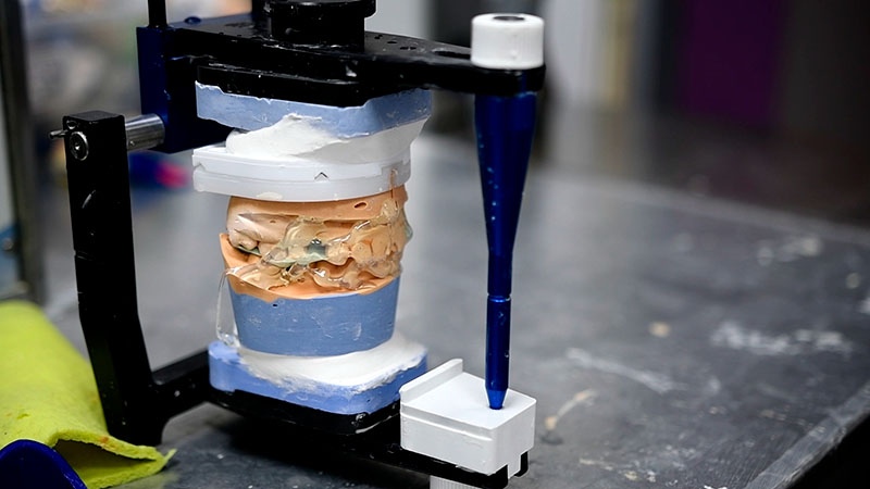 Сучасна зуботехнічна лабораторія Київ фото Люмі-Дент