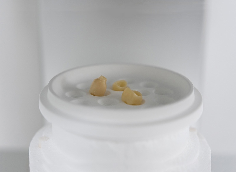 Зубной техник фото Люми-Дент