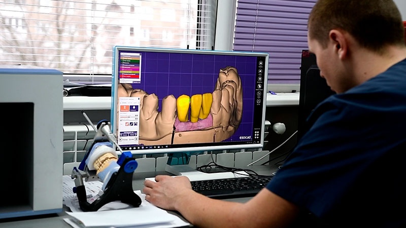 Зубний технік Київ фото Люмі-Дент