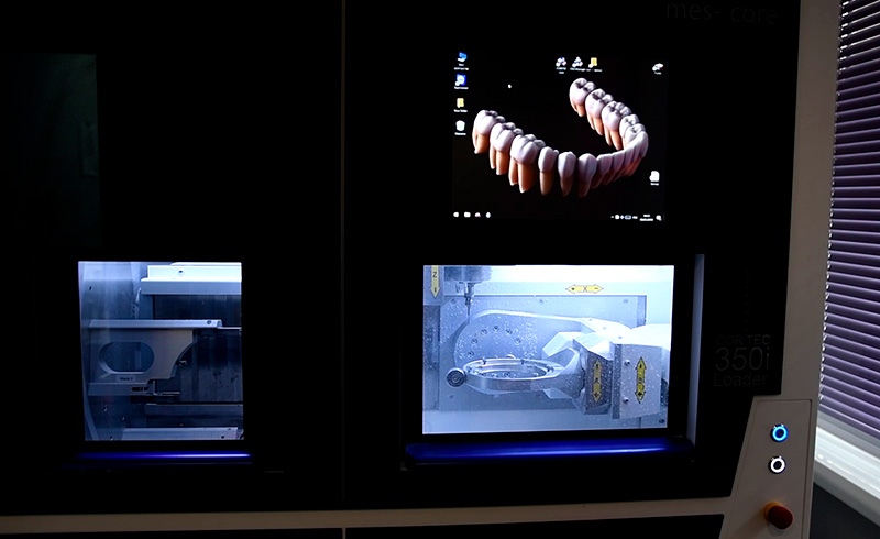 Зубные техники Киев фото Люми-Дент