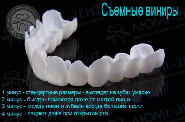 Съемные виниры на зубы фото Люми-Дент