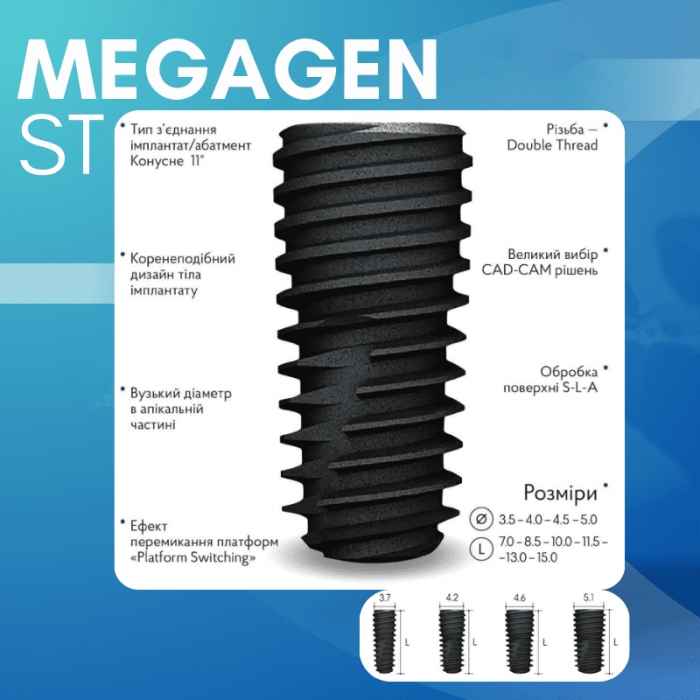 Акция на имплант MegaGen ST фото Люми-Дент
