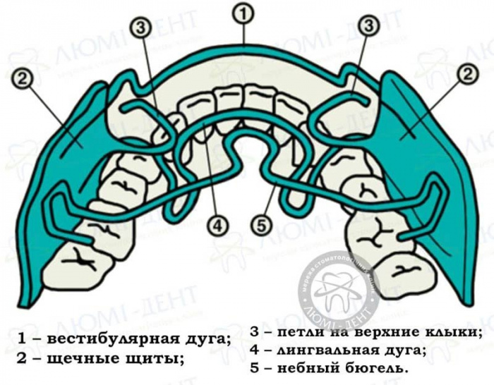 аппараты френкеля фото ЛюмиДент