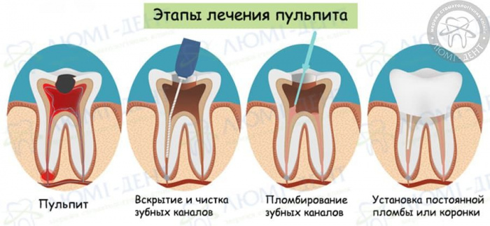 Стоматологическое лечение зубов фото ЛюмиДент