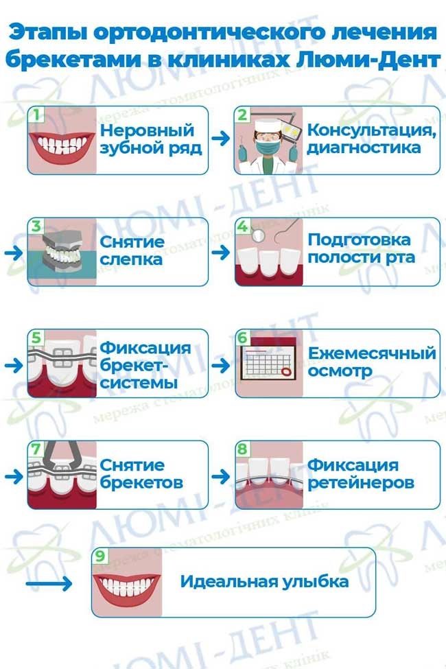 Минивинты в ортодонтии фото Люми-Дент