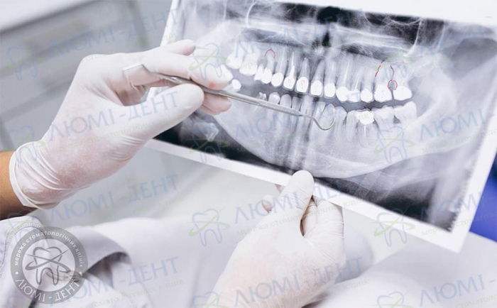 Панорамний знімок зубів як роблять фото ЛюміДент