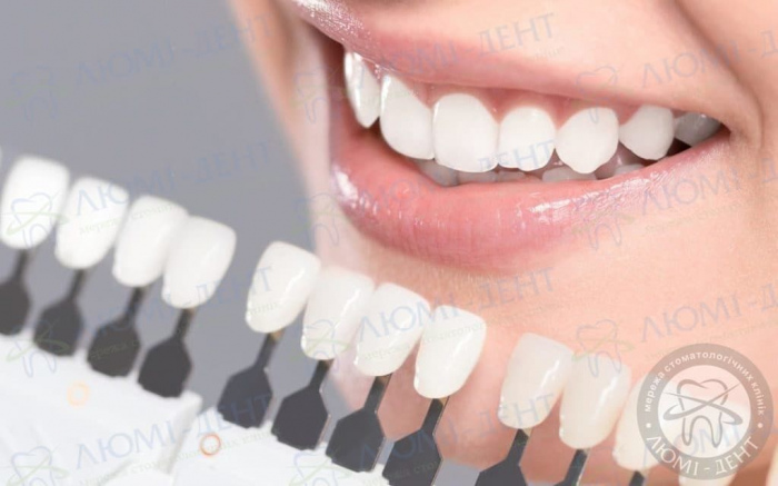 вирівнювання зубів вінірами фото ЛюміДент