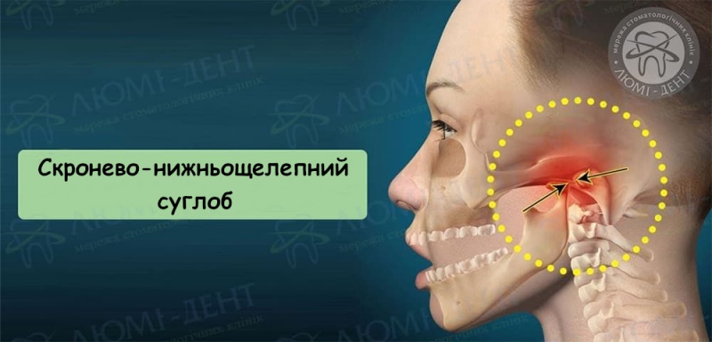 Скронево-нижньощелепний суглоб фото Люмі-Дент