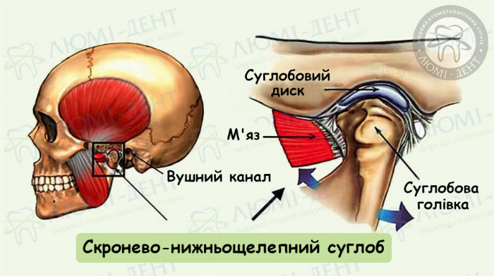 Дисфункція скронево нижньощелепного суглоба фото ЛюміДент