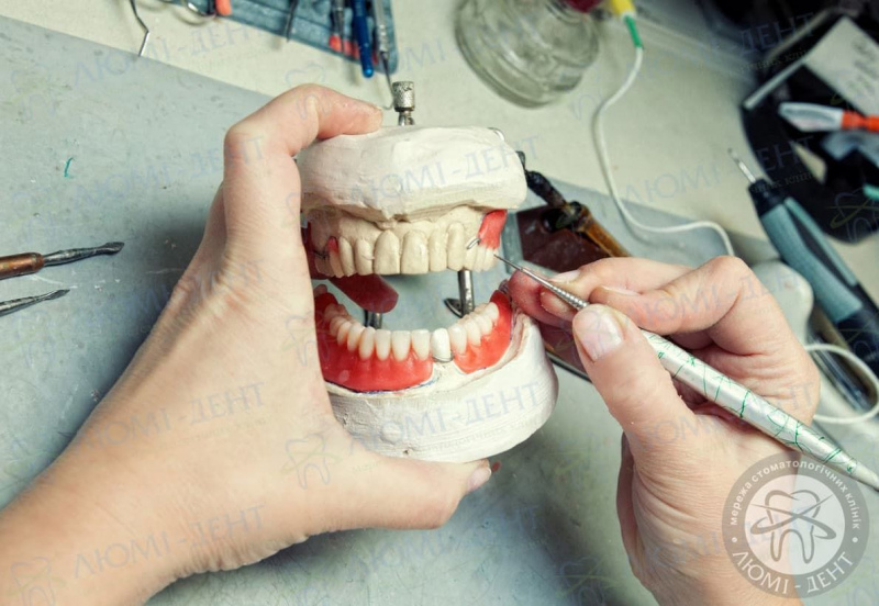 как делают зубные протезы фото ЛюмиДент
