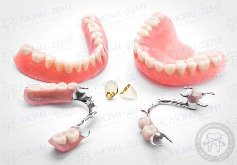 протези зубів фото ЛюміДент