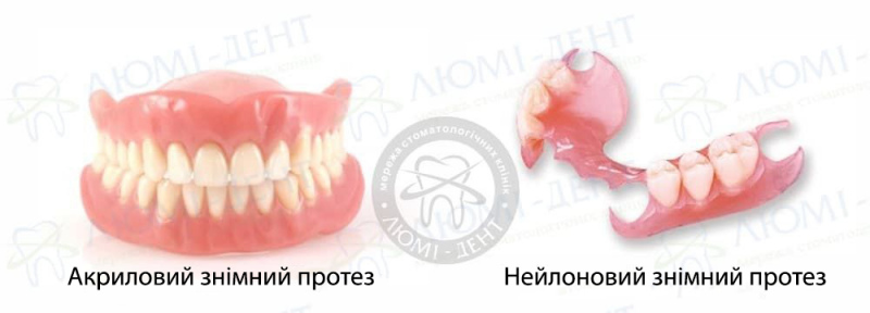 верхній знімний зубний протез фото ЛюміДент