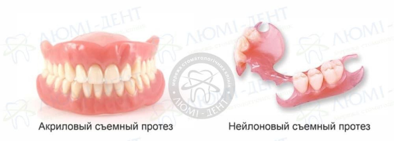 верхний съемный зубной протез фото ЛюмиДент