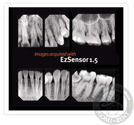Рентген зубов снимок стоматология Люмидент Киев 