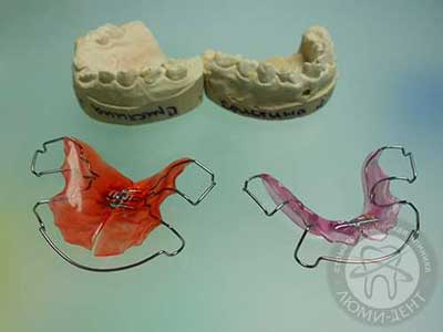 Пластинка на зуби фото Люмі Дент