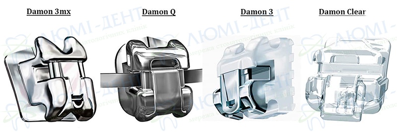 Виды брекетов Даймон Брекет damon clear фото Люми-Дент