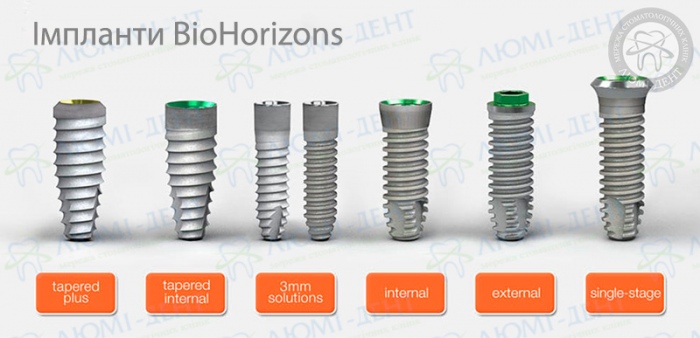 Імплант біогоризонт фото ЛюміДент