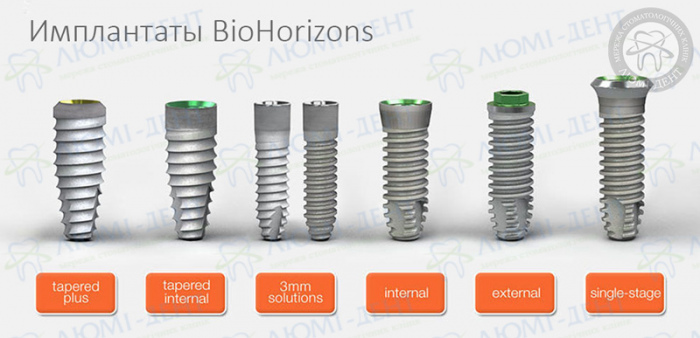 Импланты biohorizons фото ЛюмиДент