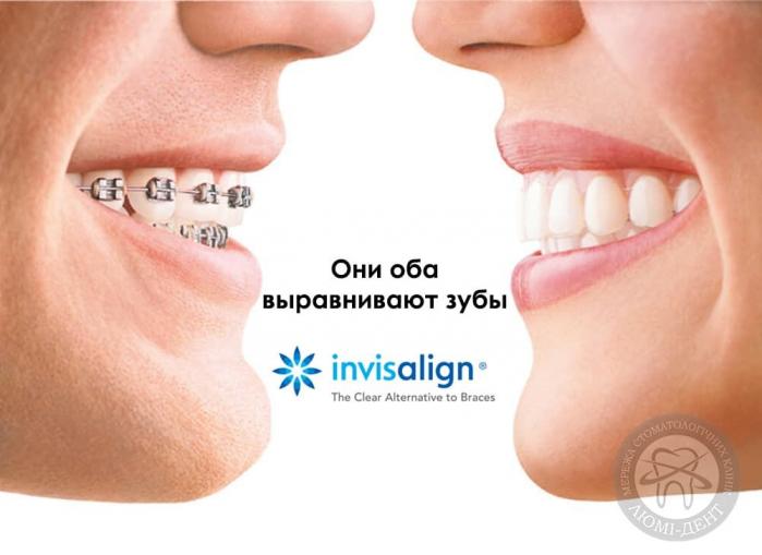Капы Invisalighn Киев Инвизилайн капы фото Люми-Дент