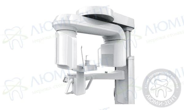Компьютерная томография челюсти фото Люми-Дент