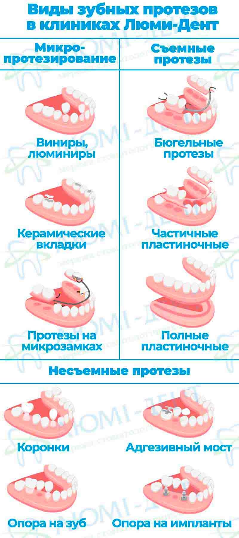 Коронки на зубы виды фото Люми-Дент