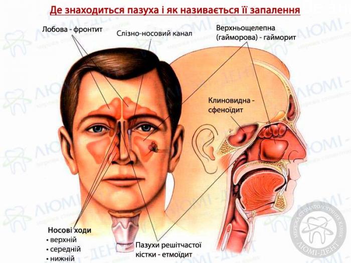 Де знаходиться пазуха і як називається її запалення кт пазух носа фото ЛюміДент
