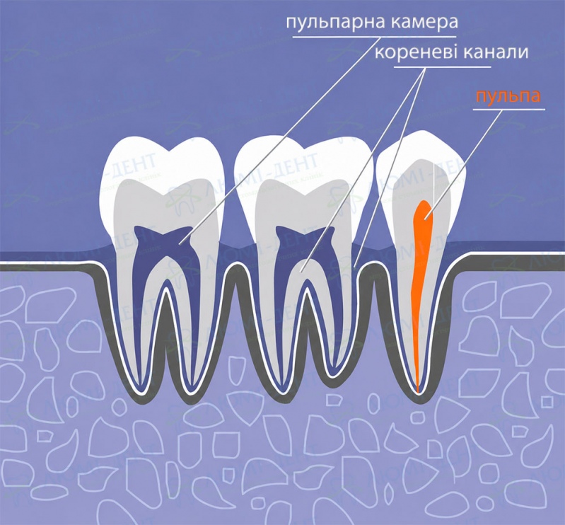 будова зуба і розташування кореневих каналів.