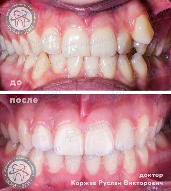 Ортодонт Київ фото Люмі-Дент