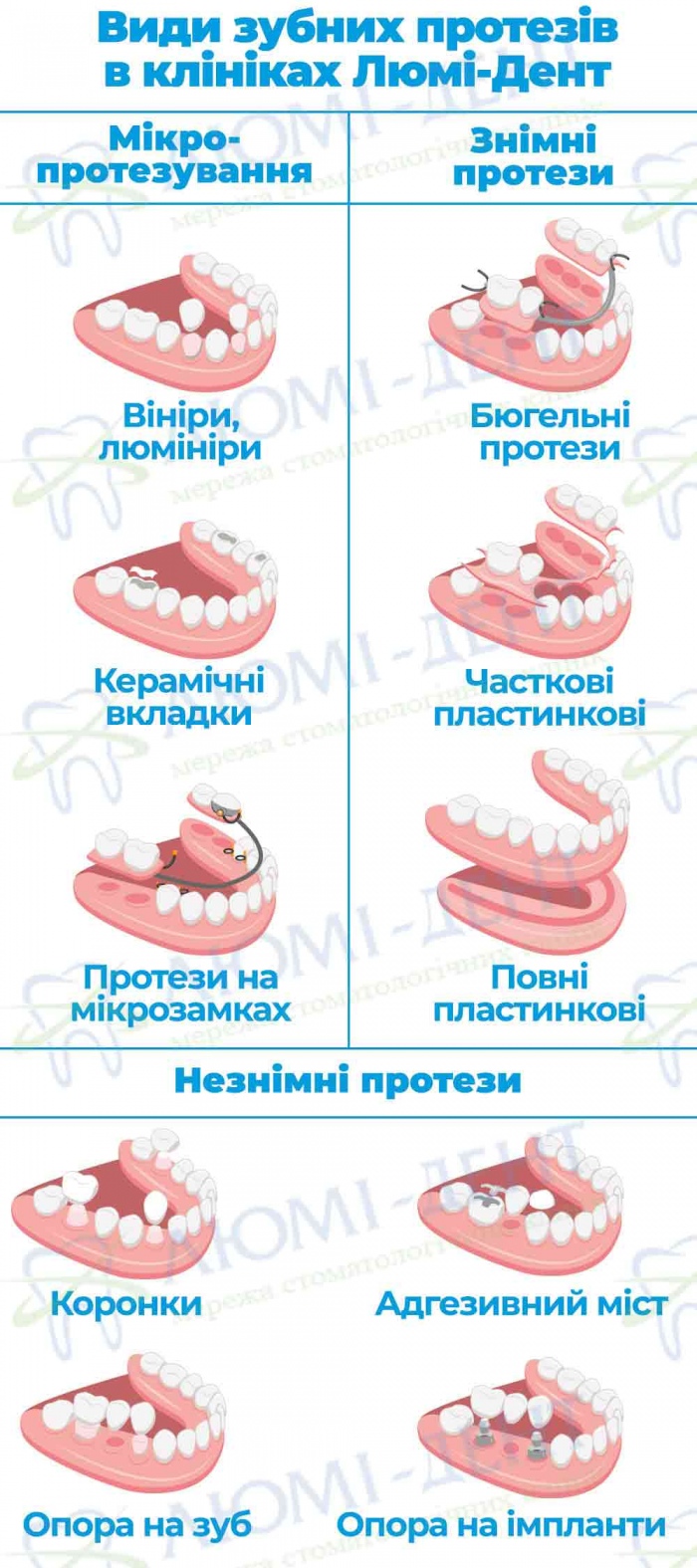 Види протезів зубів Види протезів зубів