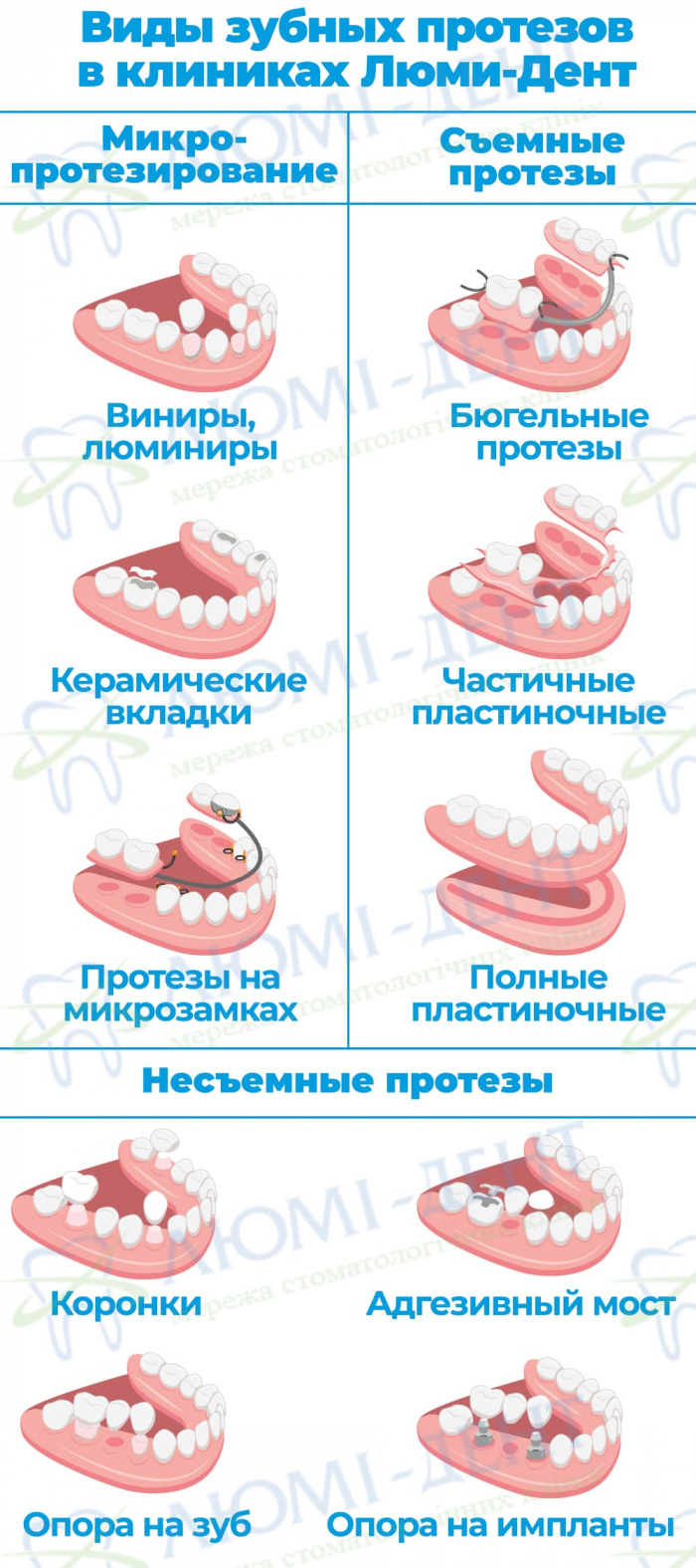 Металлокерамика коронки фото Люми-Дент