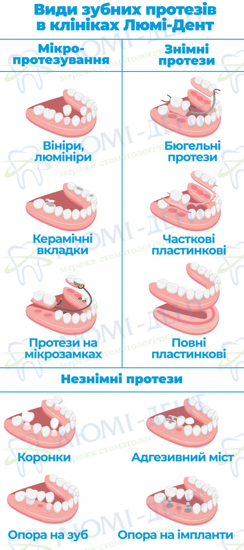 Коронки на зуби види фото Люмі-Дент