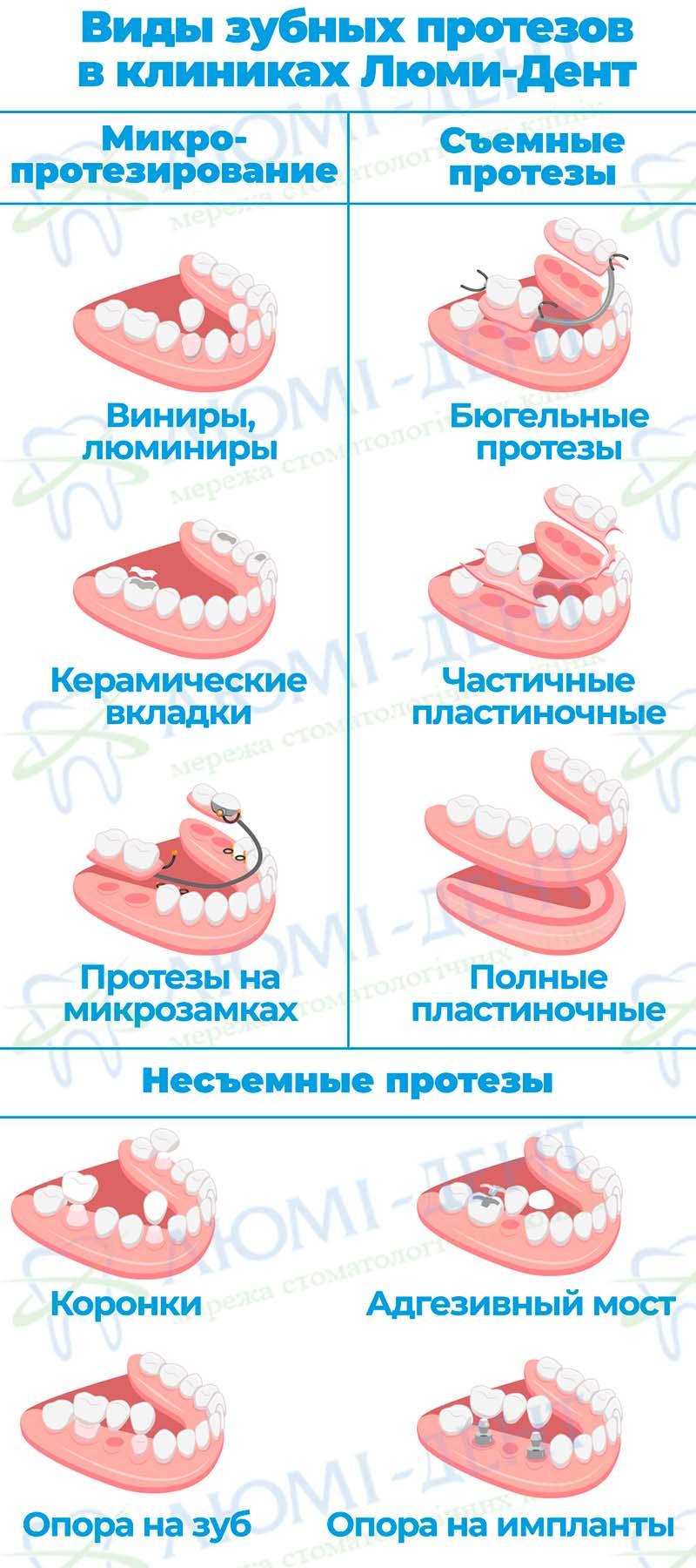 Виды протезов зубов Съемные зубные протезы фото Люми-Дент