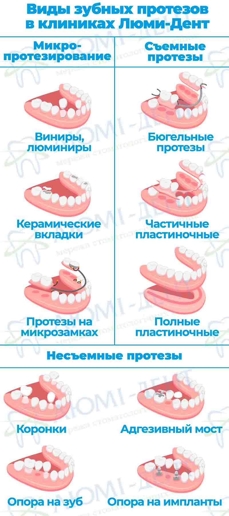 Съемные зубные протезы фото Люми-Дент