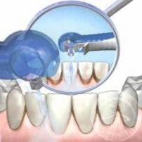 Аппарат вектор для лечения пародонтита фото Люми-Дент