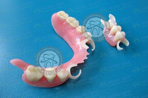 Частичные съемные протезы стоматология фото Люми-Дент