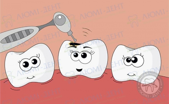 Лікування зубів дитині під наркозом фото Люмі-Дент