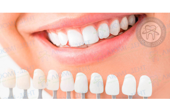 Накладки на зуби фото ЛюміДент