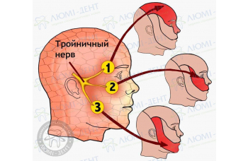 Тройничный нерв фото ЛюмиДент